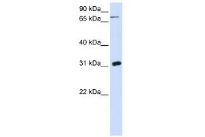 UPP1 antibody used at 1 ug/ml to detect target protein. (UPP1 Antikörper  (N-Term))