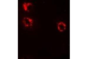 Immunofluorescent analysis of Anamorsin staining in HepG2 cells.