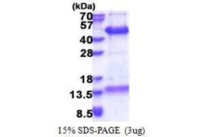 Family with Sequence Similarity 84, Member B (FAM84B) (AA 1-310) protein (His tag)