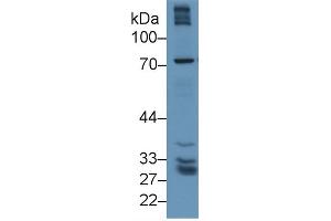 Western Blot; Sample: Human Lung lysate; Primary Ab: 1µg/ml Rabbit Anti-Human gGT5 Antibody Second Ab: 0. (GGT5 Antikörper  (AA 388-586))