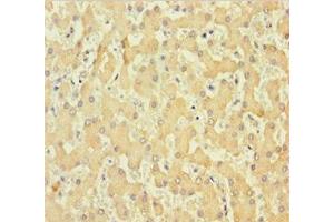 Immunohistochemistry of paraffin-embedded human liver tissue using ABIN7148261 at dilution of 1:100 (Collagen, Type VI, alpha 6 (COL6A6) (AA 430-982) Antikörper)