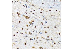 Immunohistochemistry of paraffin-embedded mouse spinal cord using CAMKIV Rabbit mAb (ABIN7266021) at dilution of 1:100 (40x lens). (CAMK4 Antikörper)