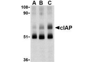 Western blot analysis of c-IAP in human lung lysate with AP30228PU-N c-IAP antibody at 1 (lane A), 2 (lane B), and 4 (lane C) μg/ml, respectively.