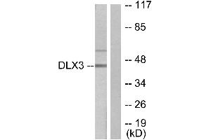 Immunohistochemistry analysis of paraffin-embedded human heart tissue using DLX3 antibody. (DLX3 Antikörper  (Internal Region))