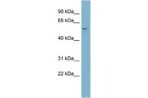 Human NCI-H226; WB Suggested Anti-ACD Antibody Titration: 0. (ACD Antikörper  (Middle Region))