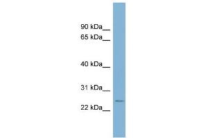 WB Suggested Anti-CD160 Antibody Titration:  0.