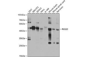 Western blot analysis of extracts of various cell lines, using RGS20 antibody (ABIN6132187, ABIN6146920, ABIN6146921 and ABIN6224191) at 1:1000 dilution. (RGS20 Antikörper  (AA 1-241))