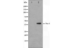 Western blot analysis on 293 cell lysate using Pax-5 Antibody. (PAX5 Antikörper  (N-Term))