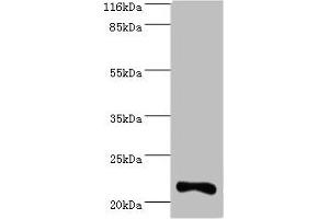 Western blot All lanes: IFNA10 antibody at 2 μg/mL + Mouse kidney tissue Secondary Goat polyclonal to rabbit IgG at 1/10000 dilution Predicted band size: 22 kDa Observed band size: 22 kDa (IFNA1 Antikörper  (AA 24-189))