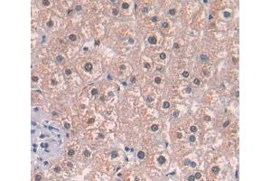 IHC-P analysis of liver tissue, with DAB staining. (Acetyl-CoA Carboxylase beta Antikörper  (AA 29-249))