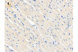 ABIN6265678 and ABIN6266689 at 1/100 staining Rat heart tissue by IHC-P. (TP53I11 Antikörper  (N-Term))