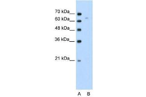 Human Jurkat; WB Suggested Anti-TOX Antibody Titration: 0. (TOX Antikörper  (N-Term))