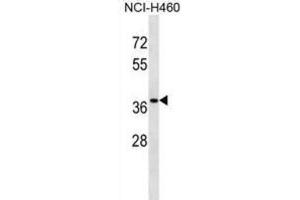 Western Blotting (WB) image for anti-CutC Copper Transporter Homolog (CUTC) antibody (ABIN2999019) (CUTC Antikörper)