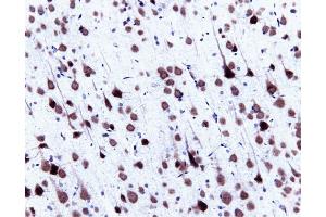 Immunohistochemistry (Paraffin-embedded Sections) (IHC (p)) image for anti-Small Nuclear Ribonucleoprotein Polypeptide N (SNRPN) (AA 14-174) antibody (ABIN968086)