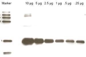 Western blot using anti-Yeast ULP-1 antibody shows detection of a truncated ULP-1 fusion protein (arrowhead).