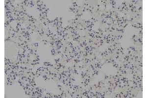 ABIN6277745 at 1/100 staining Rat lung tissue by IHC-P. (MDM4-binding Protein Antikörper  (Internal Region))