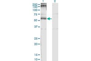 Western Blot analysis of CHRND expression in transfected 293T cell line by CHRND monoclonal antibody (M01), clone 2B2.