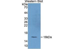 Western blot analysis of the recombinant protein. (REG4 Antikörper  (AA 45-151))