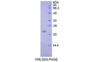 SDS-PAGE analysis of Human REXO2 Protein. (REXO2 Protein)