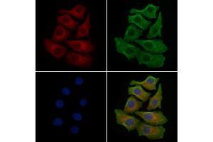 ABIN6259184 and ABIN6275514 staining HepG2 cells by IF/ICC. (SCFD1 Antikörper  (C-Term))