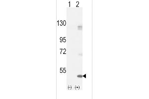 Western blot analysis of FGFR1 (arrow) using rabbit polyclonal FGFR1-p h. (FGFR1 Antikörper  (AA 132-161))