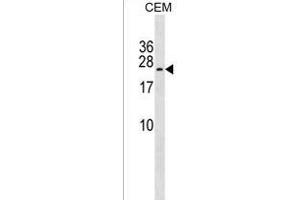 TAK1L Antibody (C-term) (ABIN1536861 and ABIN2838127) western blot analysis in CEM cell line lysates (35 μg/lane). (MAP3K7CL Antikörper  (C-Term))