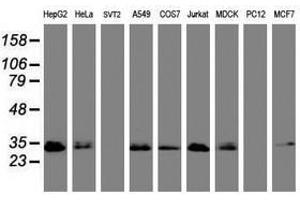 Image no. 3 for anti-Palmitoyl-Protein Thioesterase 1 (PPT1) (AA 100-306) antibody (ABIN1490801) (PPT1 Antikörper  (AA 100-306))