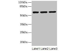 Western blot All lanes: MIER2 antibody at 4 μg/mL Lane 1: Jurkat whole cell lysate Lane 2: HepG2 whole cell lysate Lane 3: A549 whole cell lysate Secondary Goat polyclonal to rabbit IgG at 1/10000 dilution Predicted band size: 60 kDa Observed band size: 60 kDa (MIER2 Antikörper  (AA 1-545))