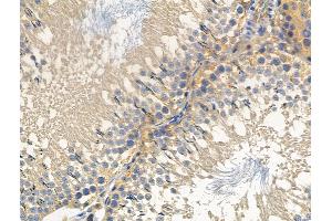 ABIN6256975 and ABIN6275033 at 1/100 staining Rat testis tissue by IHC-P. (C1QBP Antikörper  (Internal Region))