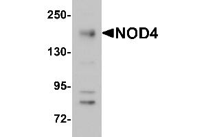 Western Blotting (WB) image for anti-NLR Family, CARD Domain Containing 5 (NLRC5) (N-Term) antibody (ABIN1031483)