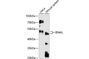 Western blot analysis of extracts of various cell lines, using IFI44L antibody (ABIN6130508, ABIN6142170, ABIN6142171 and ABIN6217125) at 1:3000 dilution. (IFI44L Antikörper  (AA 1-200))