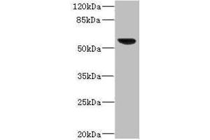 Western blot All lanes: SOAT2 antibody IgG at 3. (SOAT2 Antikörper  (AA 1-120))