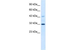 Western Blotting (WB) image for anti-Voltage-Dependent Anion Channel 1 (VDAC1) antibody (ABIN2461102) (VDAC1 Antikörper)