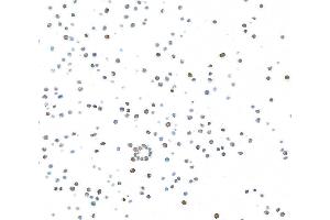 Immunocytochemistry (ICC) image for anti-Antigen Identified By Monoclonal Antibody Ki-67 (MKI67) (AA 1200-1250) antibody (ABIN7448915) (Rekombinanter Ki-67 Antikörper  (AA 1200-1250))