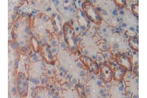 Immunohistochemistry (IHC) image for anti-Cadherin-16 (CDH16) (AA 353-617) antibody (ABIN7441937)