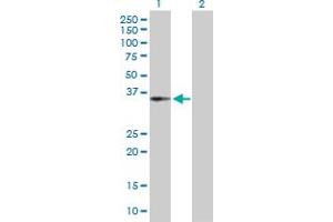 Western Blot analysis of CENPH expression in transfected 293T cell line by CENPH MaxPab polyclonal antibody. (CENPH Antikörper  (AA 1-247))