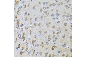 Immunohistochemistry of paraffin-embedded rat brain using BTD antibody at dilution of 1:100 (40x lens). (BTD Antikörper)
