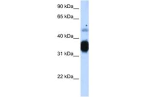 Western Blotting (WB) image for anti-Fast Skeletal Troponin T (TNNT3) antibody (ABIN2463422) (TNNT3 Antikörper)