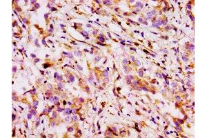 Immunohistochemistry (IHC) image for anti-ATP-Binding Cassette, Sub-Family B (MDR/TAP), Member 1 (ABCB1) (AA 236-297) antibody (ABIN7160310)