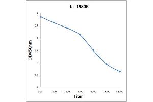 Antigen: 0. (MASP2 Antikörper  (AA 351-450))