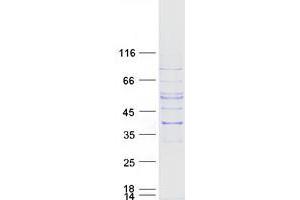 Western Blotting (WB) image for Solute Carrier Family 25 (Mitochondrial Carrier, Graves Disease Autoantigen), Member 16 (SLC25A16) protein (Myc-DYKDDDDK Tag) (ABIN2732157)
