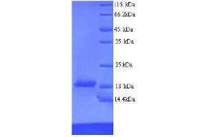 SDS-PAGE (SDS) image for Ribonucleoprotein, PTB-Binding 2 (RAVER2) (AA 1-140), (partial) protein (His tag) (ABIN5714484) (RAVER2 Protein (AA 1-140, partial) (His tag))
