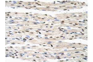 HNRPDL antibody was used for immunohistochemistry at a concentration of 4-8 ug/ml to stain Skeletal muscle cells (arrows) in Human Muscle.