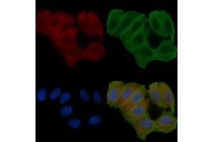 ABIN6263727 and ABIN6272622 staining Hela cells(24h of starvation treatment) by IF/ICC. (NRBP1 Antikörper  (Internal Region))