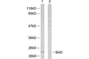 Western blot analysis of extracts from 293 cells, treated with Forskolin, using BAD (Ab-112) Antibody. (BAD Antikörper  (AA 78-127))