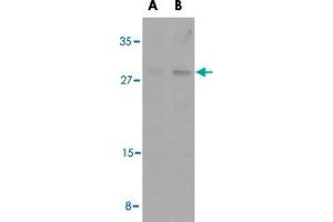 Western blot analysis of BAK1 in L1210 cell lysates with BAK1 polyclonal antibody  at (A) 1 and (B) 2 ug/mL . (BAK1 Antikörper  (N-Term))
