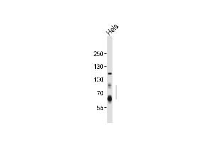Western blot analysis of lysate from Hela cell line, using PCSK9 Antibody (N-term) (ABIN652320 and ABIN2841467).