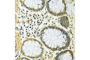 Immunohistochemistry of paraffin-embedded human colon using SLC25A1 antibody. (Slc25a1 Antikörper  (AA 1-311))