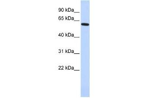 Western Blotting (WB) image for anti-Eyes Absent Homolog 1 (EYA1) antibody (ABIN2457953) (EYA1 Antikörper)