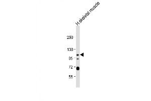 Western Blot at 1:1000 dilution + human skeletal muscle lysate Lysates/proteins at 20 ug per lane. (KCNQ5 Antikörper  (C-Term))